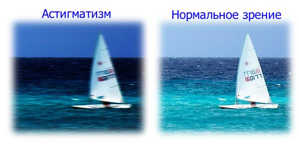 астигматизм это